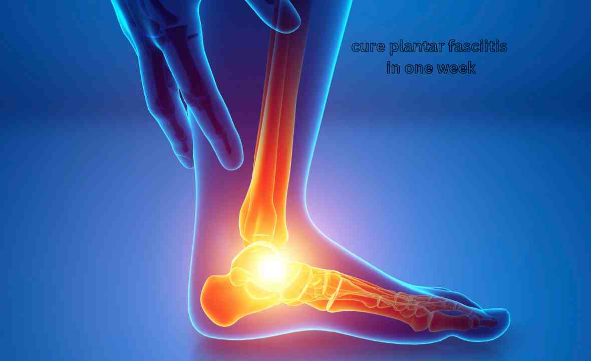 Effective Tips to Cure Plantar Fasciitis in One Week