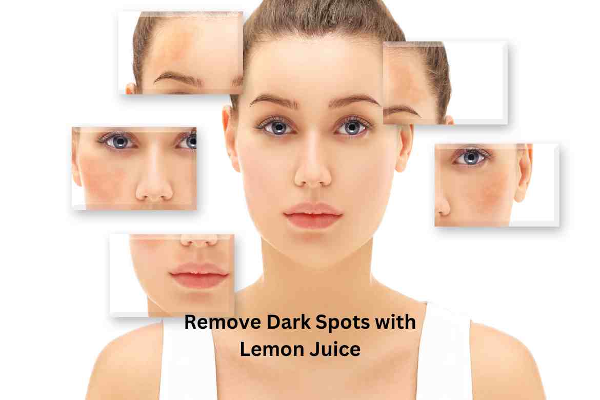 Remove Dark Spots with Lemon Juice: WellHealthOrganic Guide