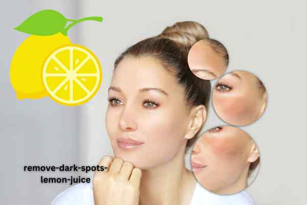 remove-dark-spots-lemon-juice